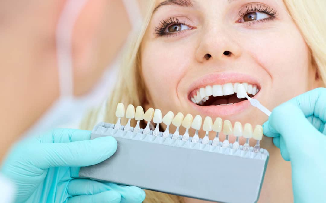 What’s The Difference Between A Root Canal And Crown? 