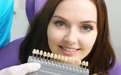 7 Things You Should Do For a White Smile 